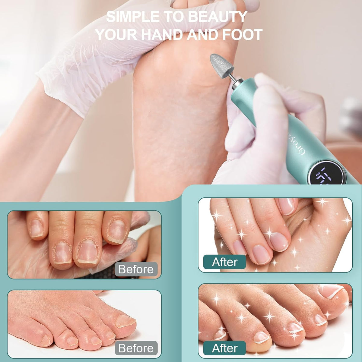 Electric Nail Drill File Professional Pen-Shaped Foot Callus Remover | Cordless Foot File for Acrylic Gel Dip Powder Nails Portable Nail Machine Kit for Dead Dry Crack Skin Calluses Foot Grinder