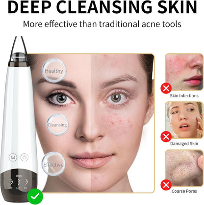 2026 Blackhead Remover Pore Vacuum Cleaner - 3 Adjustable Suction Power 6 Probes,Usb Rechargeable Blackhead Vacuum Kit Electric Acne Extractor Tool for Women